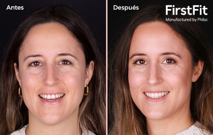 QUE ÉS FIRSTFIT?